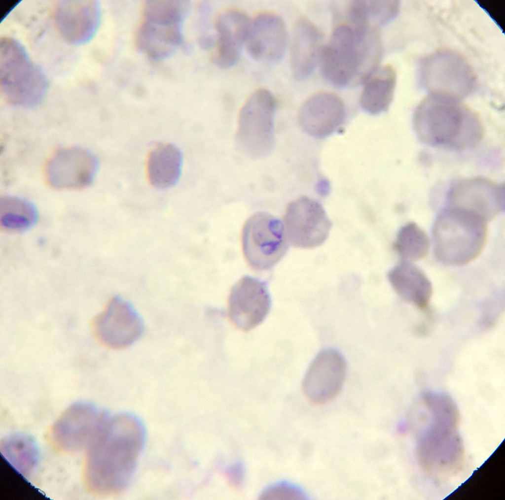 Микроскопия мазка с эритроцитами, пораженными бабезиями